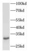 Outer Dense Fiber Of Sperm Tails 3 antibody, FNab05973, FineTest, Western Blot image 