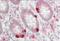Gasdermin E antibody, orb360701, Biorbyt, Immunohistochemistry paraffin image 