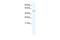 Transmembrane Protein 108 antibody, GTX47500, GeneTex, Western Blot image 
