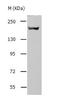 Angiotensin I Converting Enzyme antibody, TA323566, Origene, Western Blot image 