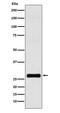 Gap Junction Protein Beta 1 antibody, M01050-1, Boster Biological Technology, Western Blot image 