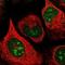 Apoptosis Enhancing Nuclease antibody, NBP2-14272, Novus Biologicals, Immunocytochemistry image 
