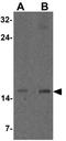 CDGSH Iron Sulfur Domain 2 antibody, GTX31533, GeneTex, Western Blot image 