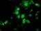 Proteasome Subunit Beta 4 antibody, LS-C173271, Lifespan Biosciences, Immunofluorescence image 