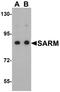 Sterile Alpha And TIR Motif Containing 1 antibody, A03633, Boster Biological Technology, Western Blot image 