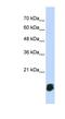 Glutaredoxin 5 antibody, NBP1-57645, Novus Biologicals, Western Blot image 