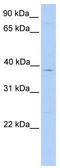Ceramide Synthase 4 antibody, TA341391, Origene, Western Blot image 