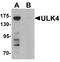Unc-51 Like Kinase 4 antibody, LS-B10173, Lifespan Biosciences, Western Blot image 