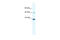 Apolipoprotein B MRNA Editing Enzyme Catalytic Subunit 3G antibody, 27-883, ProSci, Western Blot image 