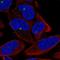 Zinc Finger Protein 766 antibody, HPA063496, Atlas Antibodies, Immunocytochemistry image 