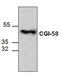 Abhydrolase Domain Containing 5 antibody, GTX59713, GeneTex, Western Blot image 