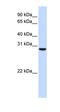 Tubulin Polyglutamylase Complex Subunit 2 antibody, orb325974, Biorbyt, Western Blot image 