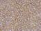 C-Terminal Src Kinase antibody, GTX107602, GeneTex, Immunohistochemistry paraffin image 