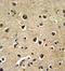 BAALC Binder Of MAP3K1 And KLF4 antibody, GTX81815, GeneTex, Immunohistochemistry paraffin image 