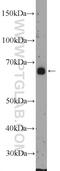 Integrator Complex Subunit 11 antibody, 15860-1-AP, Proteintech Group, Western Blot image 