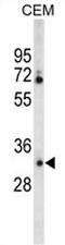 Carbonic Anhydrase 6 antibody, AP50699PU-N, Origene, Western Blot image 