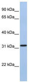 Solute Carrier Family 25 Member 28 antibody, TA333637, Origene, Western Blot image 
