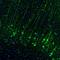 Calcium/Calmodulin Dependent Protein Kinase II Beta antibody, NBP1-88212, Novus Biologicals, Immunofluorescence image 