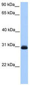 Hydroxyacylglutathione Hydrolase antibody, TA334983, Origene, Western Blot image 