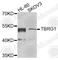 Transforming growth factor beta regulator 1 antibody, A7164, ABclonal Technology, Western Blot image 