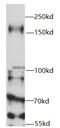 Ubiquitin Specific Peptidase 19 antibody, FNab09314, FineTest, Western Blot image 