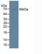 Centromere Protein I antibody, MBS2025976, MyBioSource, Western Blot image 