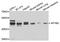 Adaptor Related Protein Complex 1 Subunit Mu 2 antibody, PA5-76366, Invitrogen Antibodies, Western Blot image 