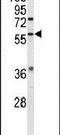 Estrogen Related Receptor Beta antibody, PA5-26070, Invitrogen Antibodies, Western Blot image 