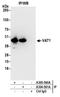 Vesicle Amine Transport 1 antibody, A305-560A, Bethyl Labs, Immunoprecipitation image 