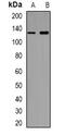TNF Receptor Superfamily Member 8 antibody, abx142270, Abbexa, Western Blot image 