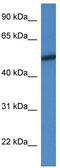Mitogen-Activated Protein Kinase 10 antibody, TA344632, Origene, Western Blot image 