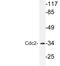 Cyclin Dependent Kinase 1 antibody, LS-C177673, Lifespan Biosciences, Western Blot image 