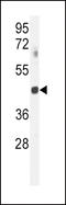 G Protein Subunit Alpha Transducin 2 antibody, LS-C166553, Lifespan Biosciences, Western Blot image 