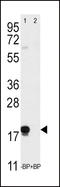 Thy-1 Cell Surface Antigen antibody, LS-B3448, Lifespan Biosciences, Western Blot image 