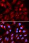 Proteasome Subunit Beta 2 antibody, LS-C334084, Lifespan Biosciences, Immunofluorescence image 