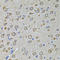Eukaryotic Translation Initiation Factor 4A2 antibody, LS-C332840, Lifespan Biosciences, Immunohistochemistry paraffin image 