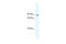 Signal Transducer And Activator Of Transcription 5B antibody, 28-622, ProSci, Enzyme Linked Immunosorbent Assay image 