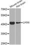 LIM homeobox protein 4 antibody, orb373942, Biorbyt, Western Blot image 