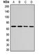 Signal Transducing Adaptor Molecule antibody, LS-C668247, Lifespan Biosciences, Western Blot image 