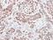 Ring Finger Protein 13 antibody, NBP1-31251, Novus Biologicals, Immunohistochemistry paraffin image 