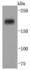 DNA Methyltransferase 1 antibody, A00172-2, Boster Biological Technology, Western Blot image 