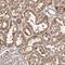 Metastasis-associated in colon cancer protein 1 antibody, HPA029476, Atlas Antibodies, Immunohistochemistry paraffin image 