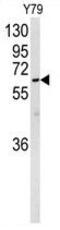 Neuralized E3 Ubiquitin Protein Ligase 1 antibody, GTX81057, GeneTex, Western Blot image 