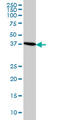 Caudal Type Homeobox 4 antibody, LS-C196893, Lifespan Biosciences, Western Blot image 