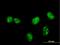 MAP kinase-interacting serine/threonine-protein kinase 1 antibody, H00008569-M14, Novus Biologicals, Immunocytochemistry image 