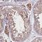 Zinc Finger MYM-Type Containing 4 antibody, PA5-62374, Invitrogen Antibodies, Immunohistochemistry frozen image 