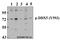 DEAD-Box Helicase 5 antibody, A00670Y593, Boster Biological Technology, Western Blot image 