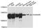 Glucosidase II Alpha Subunit antibody, A09668-1, Boster Biological Technology, Western Blot image 