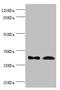 ZW10 Interacting Kinetochore Protein antibody, LS-C676764, Lifespan Biosciences, Western Blot image 