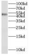 Serpin Family B Member 2 antibody, FNab07746, FineTest, Western Blot image 